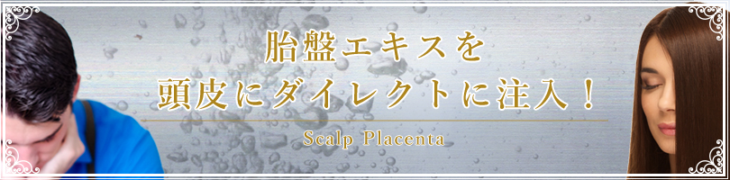 頭皮プラセンタ注射