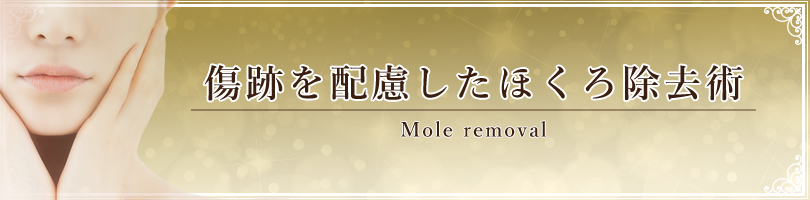 ほくろ除去