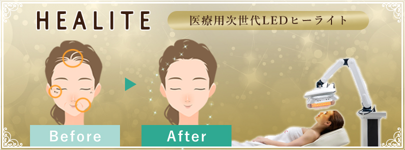 ヒーライトⅡ
